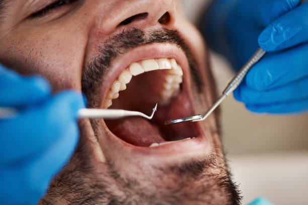 Best Emergency Dental Extractions in Woodland Heights, PA